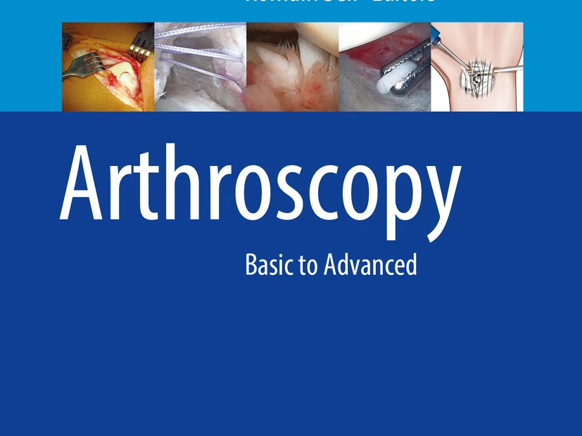 Arthroscopy
