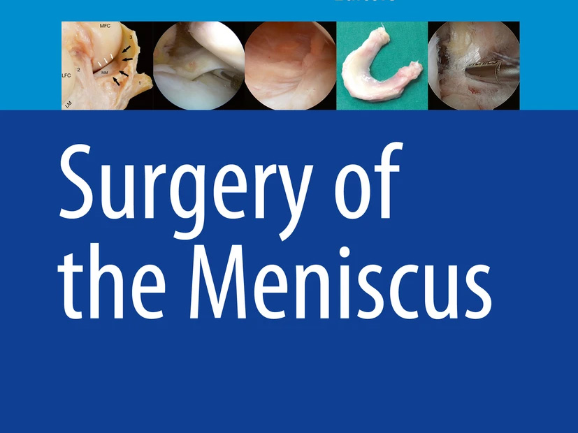 Surgery of the Meniscus
